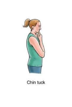 chin tuck exercises for neck spasm rehabilitation
