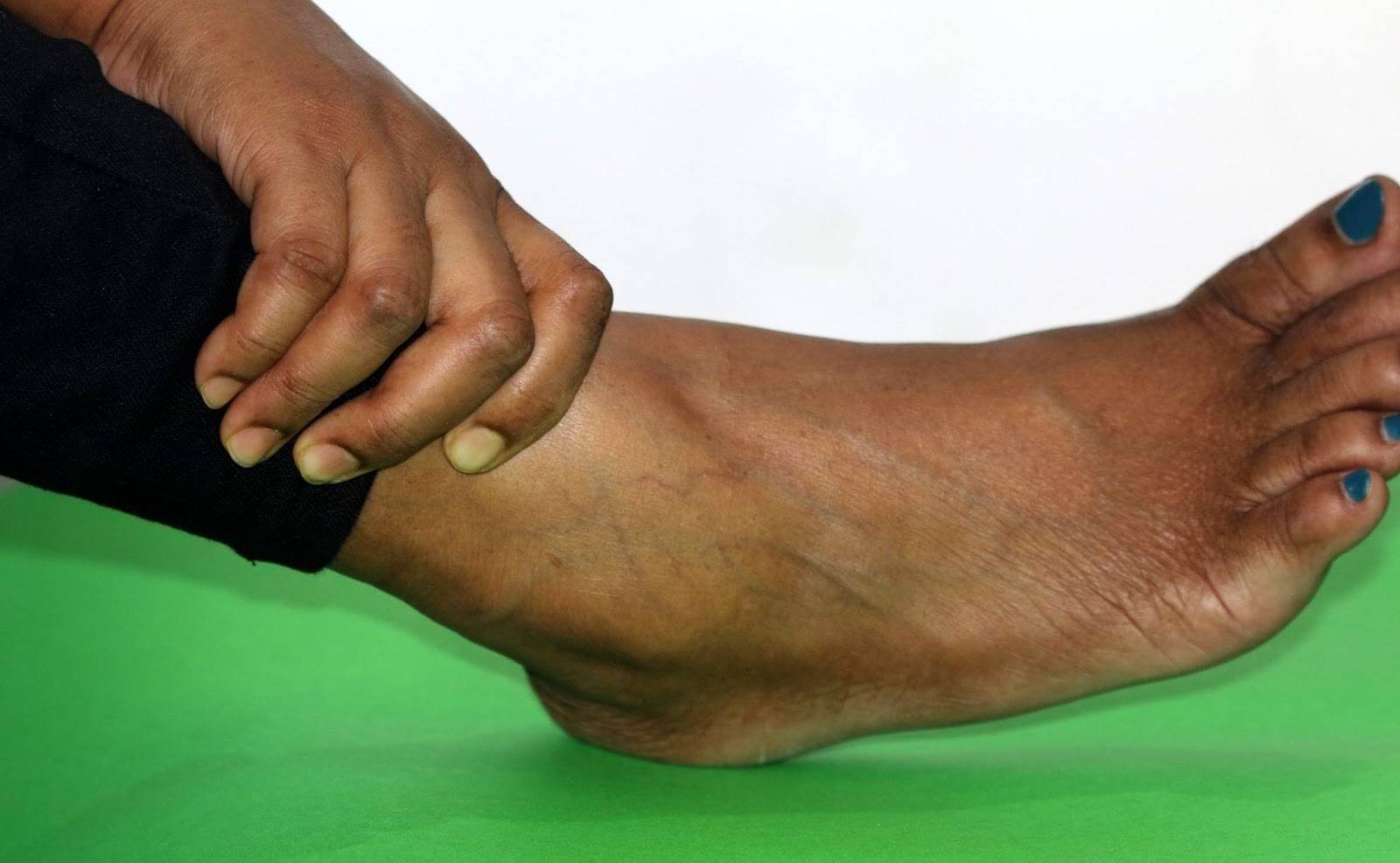 Treatment for ligament injury in Charlotte, NC