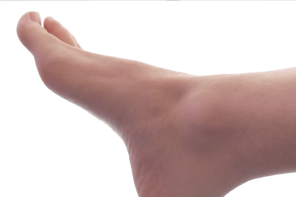 non-surgical, non-opiate foot pain management charlotte